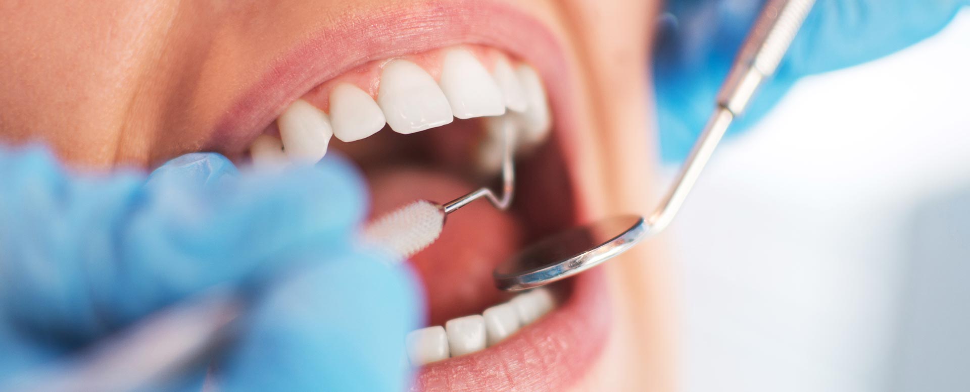 Zahn Abgebrochen Aufbewahrung Und Hilfe Ergoimpulse